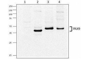 Western Blotting (WB) image for anti-Paired Box 9 (PAX9) antibody (ABIN2665320) (PAX9 anticorps)