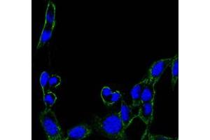 Immunofluorescence analysis of B16 cells using FAK mouse mAb (green). (FAK anticorps)