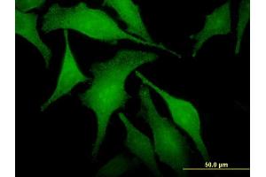 Immunofluorescence of monoclonal antibody to SNX6 on HeLa cell. (SNX6 anticorps  (AA 1-290))