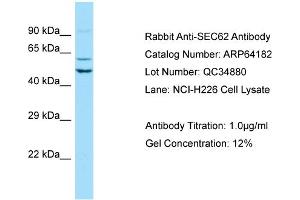 Western Blotting (WB) image for anti-Translocation Protein 1 (TLOC1) (Middle Region) antibody (ABIN2774392) (SEC62 anticorps  (Middle Region))