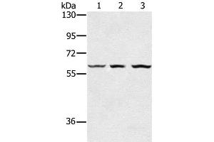 Western Blot analysis of Human breast infiltRative duct tissue, Jurkat and HT-29 cell using OXSR1 Polyclonal Antibody at dilution of 1:300