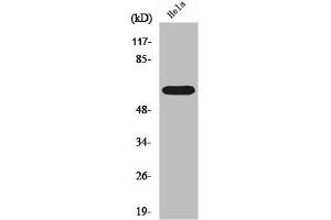 Western Blot analysis of Hela cells using RORα Polyclonal Antibody (RORA anticorps  (N-Term))
