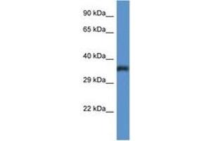 Image no. 1 for anti-Phosphatidylinositol Glycan C (PIGC) (C-Term) antibody (ABIN6746921) (PIGC anticorps  (C-Term))