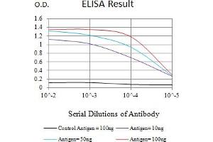 Black line: Control Antigen (100 ng),Purple line: Antigen (10 ng), Blue line: Antigen (50 ng), Red line:Antigen (100 ng)
