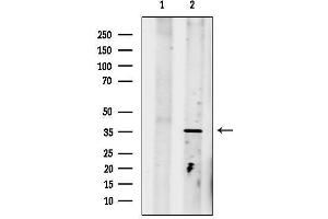 anti-Paired-Like Homeodomain 2 (PITX2) (Internal Region) antibody