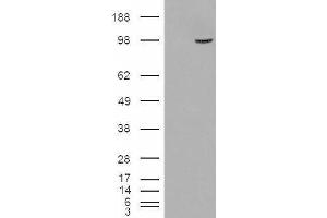 HEK293 overexpressing SMEK1 (ABIN5408171) and probed with ABIN334493 (mock transfection in first lane). (SMEK1 anticorps  (Internal Region))