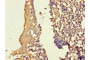 Immunohistochemistry of paraffin-embedded human tonsil tissue using ABIN7155297 at dilution of 1:100 (ASF1B anticorps  (AA 1-202))