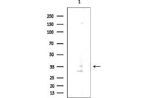Western blot analysis of lysates from EC304 cells(heat-shock treatment), using OR4K14 Antibody at 1/1000 dilution.