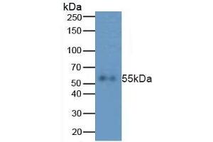 Rabbit Capture antibody from the kit in WB with Positive Control:  HepG2 cell lysate.
