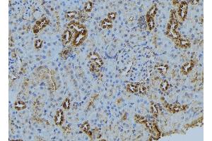 ABIN6272874 at 1/100 staining Mouse kidney tissue by IHC-P. (BBS5 anticorps  (C-Term))