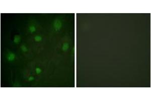 Immunofluorescence analysis of HeLa cells, using IGF2R (Ab-2484) Antibody. (IGF2R anticorps  (AA 2441-2490))