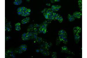 Image no. 3 for anti-Proteasome (Prosome, Macropain) 26S Subunit, ATPase, 3 (PSMC3) antibody (ABIN1501335)
