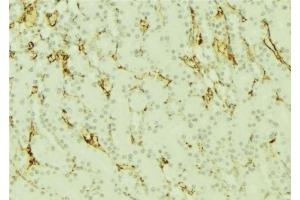 ABIN6277296 at 1/100 staining Mouse kidney tissue by IHC-P. (Dynamin 1-Like anticorps  (C-Term))