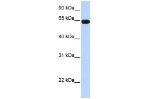 WB Suggested Anti-C16orf44 Antibody Titration:  0. (KLHL36 anticorps  (Middle Region))