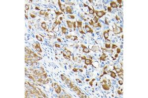 Immunohistochemistry of paraffin-embedded rat ovary using eEF1 Rabbit pAb (7857) at dilution of 1:100 (40x lens).