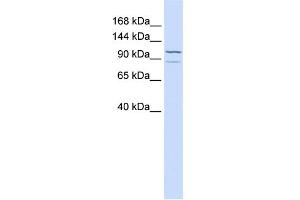 WB Suggested Anti-ADCY6 Antibody Titration:  0. (ADCY6 anticorps  (C-Term))
