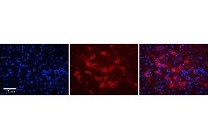 Rabbit Anti-DCAF11 Antibody      Formalin Fixed Paraffin Embedded Tissue: Human Adult Liver   Observed Staining: Cytoplasm in hepatocytes, strong signal, moderate tissue distribution  Primary Antibody Concentration: 1:100  Secondary Antibody: Donkey anti-Rabbit-Cy3  Secondary Antibody Concentration: 1:200  Magnification: 20X  Exposure Time: 0.