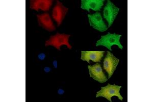 ABIN7097135 and ABIN7101203 staining  cells by IF/ICC.