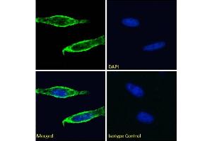 Immunofluorescence staining of fixed HeLa cells with anti-CD98 antibody CP1-5.