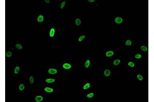 anti-Histone Cluster 1, H3a (HIST1H3A) (acLys23) antibody