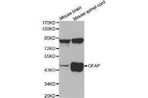 Western Blotting (WB) image for anti-Glial Fibrillary Acidic Protein (GFAP) (C-Term) antibody (ABIN6213705) (GFAP anticorps  (C-Term))
