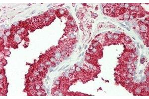 Detection of CPT1A in Human Prostate Tissue using Polyclonal Antibody to Carnitine Palmitoyltransferase 1A, Liver (CPT1A)