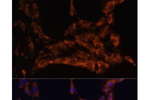 Immunofluorescence analysis of C6 cells using IL18 Polyclonal Antibody at dilution of 1:100. (IL-18 anticorps)