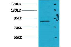 Western Blotting (WB) image for anti-Signal Transducer and Activator of Transcription 5A (STAT5A) antibody (ABIN3179114) (STAT5A anticorps)