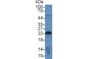 Detection of FGF13 in Rat Cerebrum lysate using Monoclonal Antibody to Fibroblast Growth Factor 13 (FGF13)