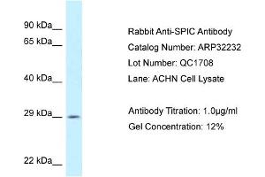WB Suggested Anti-SPIC Antibody   Titration: 1. (SPIC anticorps  (C-Term))