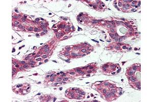 Anti-TAOK1 antibody IHC of human breast. (TAO Kinase 1 (TAOK1) (Internal Region) anticorps)
