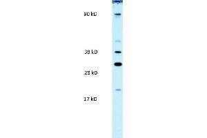 WB Suggested Anti-PAntibody Titration:  0. (PARP11 anticorps  (N-Term))