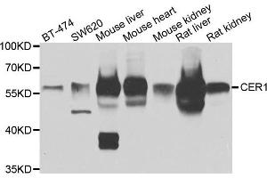 Western blot analysis of extracts of various cell lines, using CER1 antibody. (CER1 anticorps)