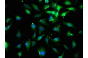 Immunofluorescence staining of U251 cells with ABIN7152751 at 1:200, counter-stained with DAPI.