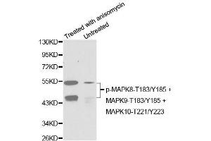 Western blot analysis of extracts from C6 cells untreated or treated with anisomycin using Phospho-MAPK8-T183/Y185 + MAPK9-T183/Y185 + MAPK10-T221/Y223 Antibody (ABIN2987800). (MAPK8/9/10 anticorps  (pThr183, pThr221, pTyr185))