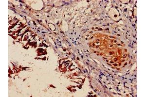 Immunohistochemistry of paraffin-embedded human lung tissue using ABIN7160596 at dilution of 1:100 (Myosin 9 anticorps  (AA 2-241))