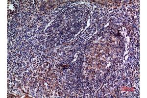 Immunohistochemistry (IHC) analysis of paraffin-embedded Human Tonsil, antibody was diluted at 1:100.