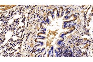 Detection of ANGPTL4 in Rat Lung Tissue using Polyclonal Antibody to Angiopoietin Like Protein 4 (ANGPTL4)