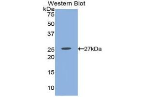 Western blot analysis of the recombinant protein. (PTGER2 anticorps  (AA 155-355))