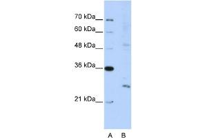 WB Suggested Anti-EXOSC4 Antibody Titration:  5. (EXOSC4 anticorps  (N-Term))