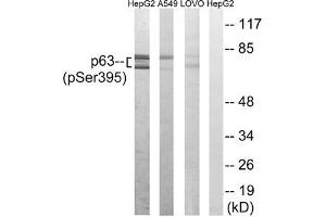 Western blot analysis of extracts from HepG2 cells, A549 cells and LOVO cells all treated with nocodazole (1 μg/mL, 18hours), using p63 (Phospho-Ser395) antibody. (p63 anticorps  (pSer395))