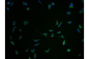 Immunofluorescence staining of SH-SY5Y cells with ABIN7168758-IF at 1:100, counter-stained with DAPI. (SEZ6 anticorps  (AA 20-267))