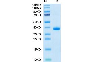 Epidermal Growth Factor (EGF) (AA 977-1029) protein (Fc Tag)