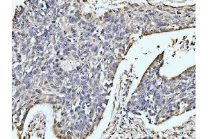 IHC analysis of MOV10 using anti-MOV10 antibody (ABIN7600236). (MOV10 anticorps  (AA 167-772))