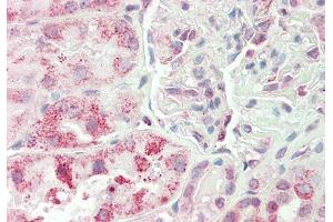 Rabbit Anti-RPN1 antibody  Formalin Fixed Paraffin Embedded Tissue: Human Kidney Primary antibody Concentration: 1:100 Secondary Antibody: Donkey anti-Rabbit-Cy3 Secondary Antibody Concentration: 1:200 Magnification: 20x Exposure Time: 0.