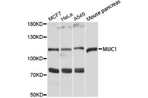 Western blot analysis of extracts of various cell lines, using MUC1 antibody.