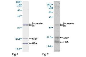 Kinase Activity Assay (KAA) image for Mitogen-Activated Protein Kinase Kinase Kinase 7 (MAP3K7) (AA 1-579) protein (GST tag) (ABIN1310225)