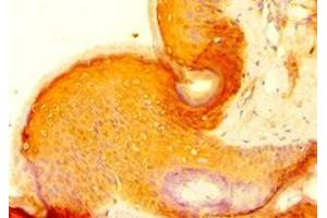 Immunohistochemistry of paraffin-embedded human skin tissue using ABIN7154835 at dilution of 1:100 (C14orf94 anticorps  (AA 1-363))