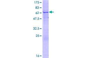 Image no. 1 for Myotubularin Related Protein 1 (MTMR1) (AA 1-363) protein (GST tag) (ABIN1311576)