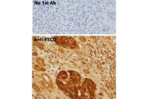 Immunohistochemistry (IHC) image for anti-Formiminotransferase Cyclodeaminase (FTCD) (N-Term) antibody (ABIN6254252)